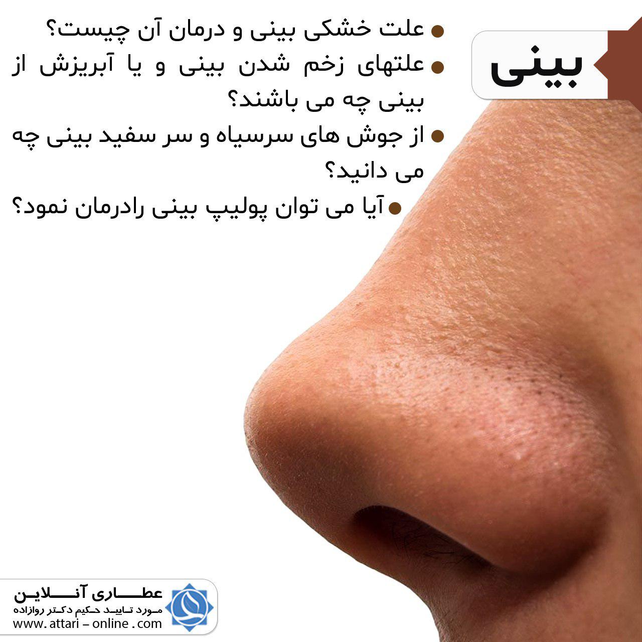 بینی 1 photo 2018 10 17 10 21 08 بینی